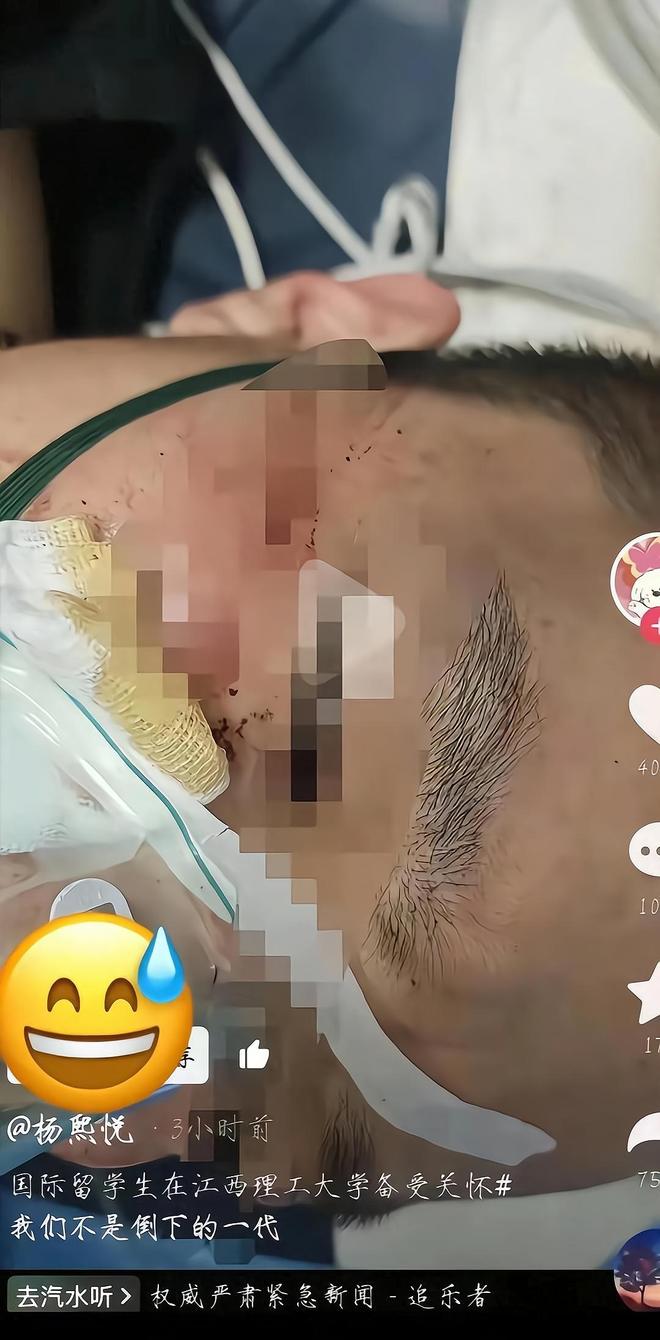 开云网站：江西理工外籍生打人后续当事人发声留学生的拳头砸痛了谁的心(图13)